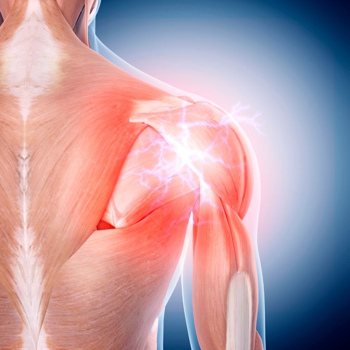 spor sonrası kas ağrısı neden olur