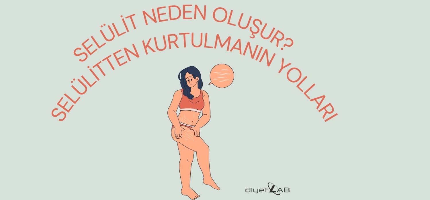Selülit Neden Oluşur? Selülitten Kurtulmanın Yolları