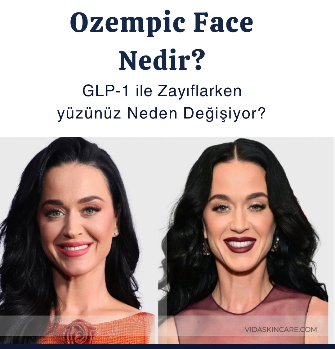 Ozempic Face Nedir ?